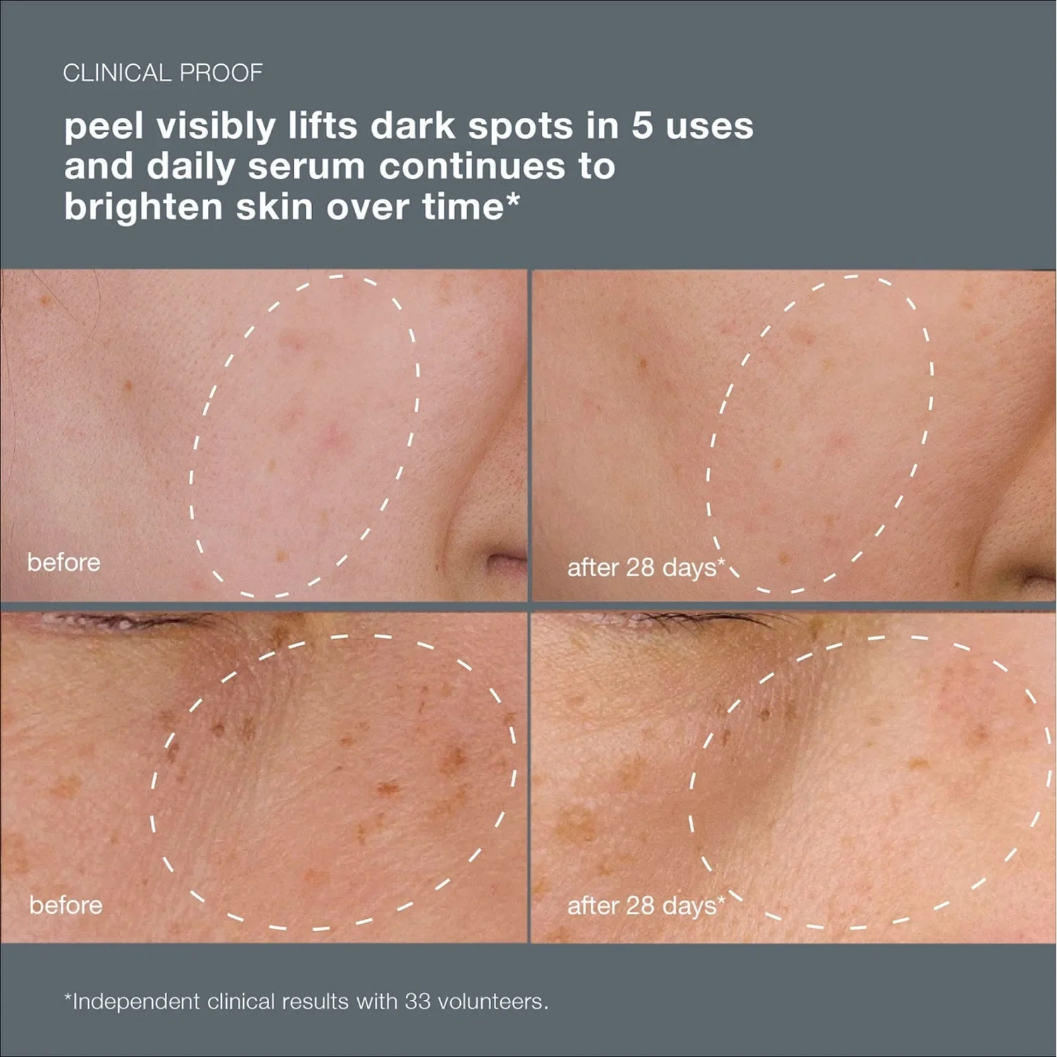 Dermalogica PowerBright Dark Spot System
