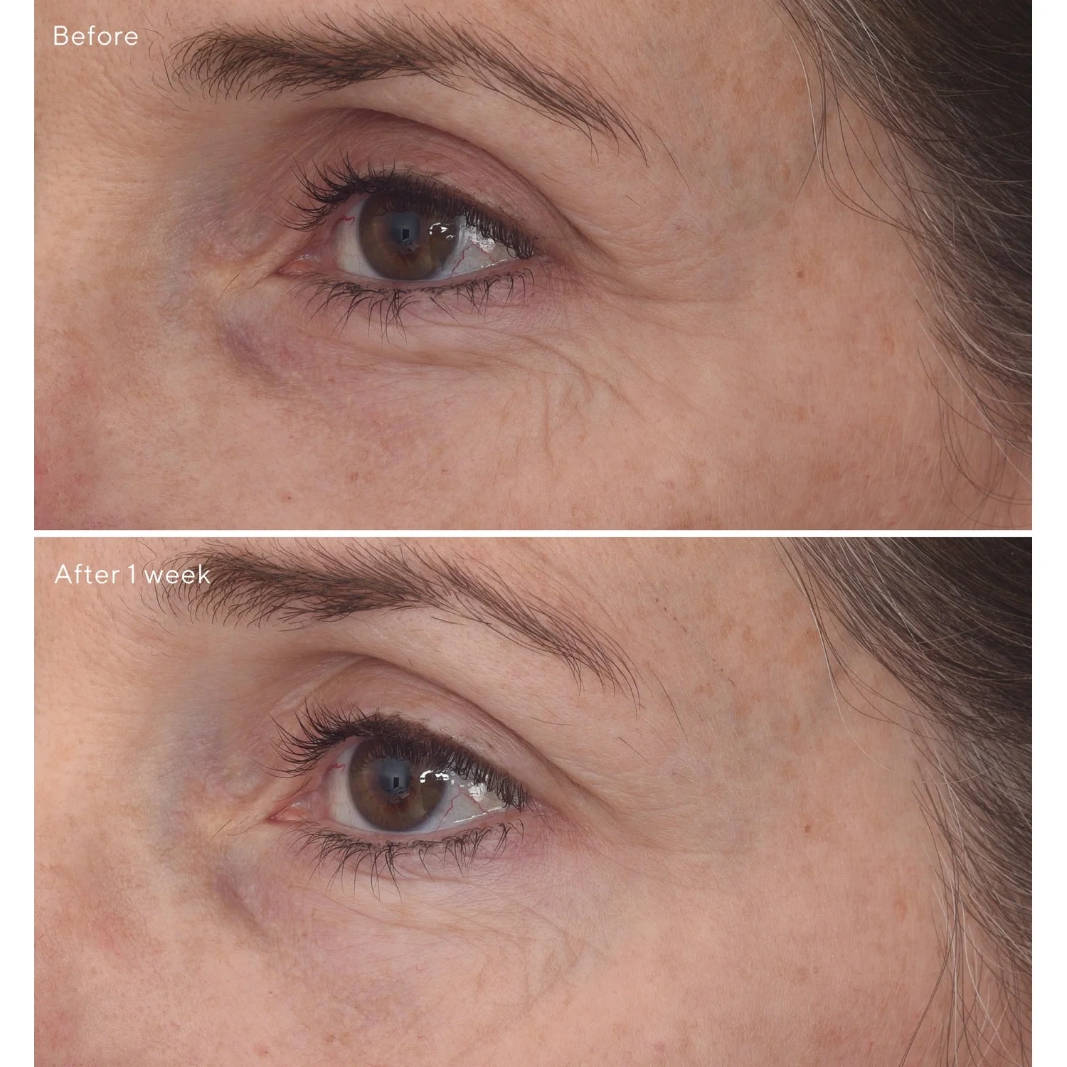 Murad Retinal ReSculpt Eye Lift Treatment 15 ml