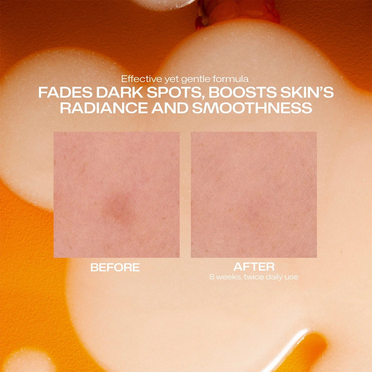 Lumene Nordic-C Dark Spot Serum