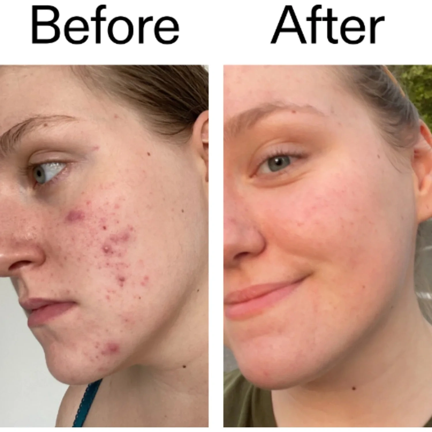 The Inkey List Vitamin C & EGF Serum 30 ml