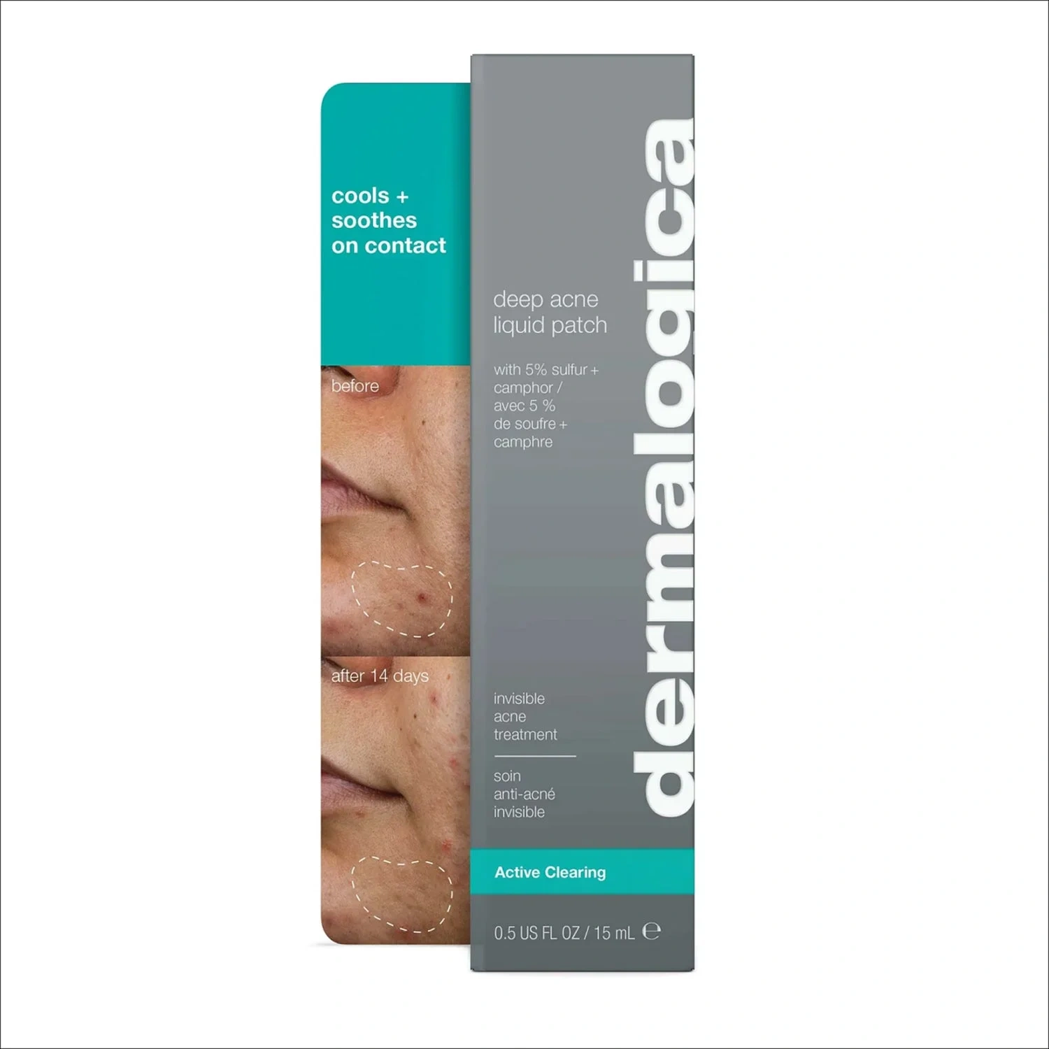 Dermalogica Deep Acne Liquid Patch
