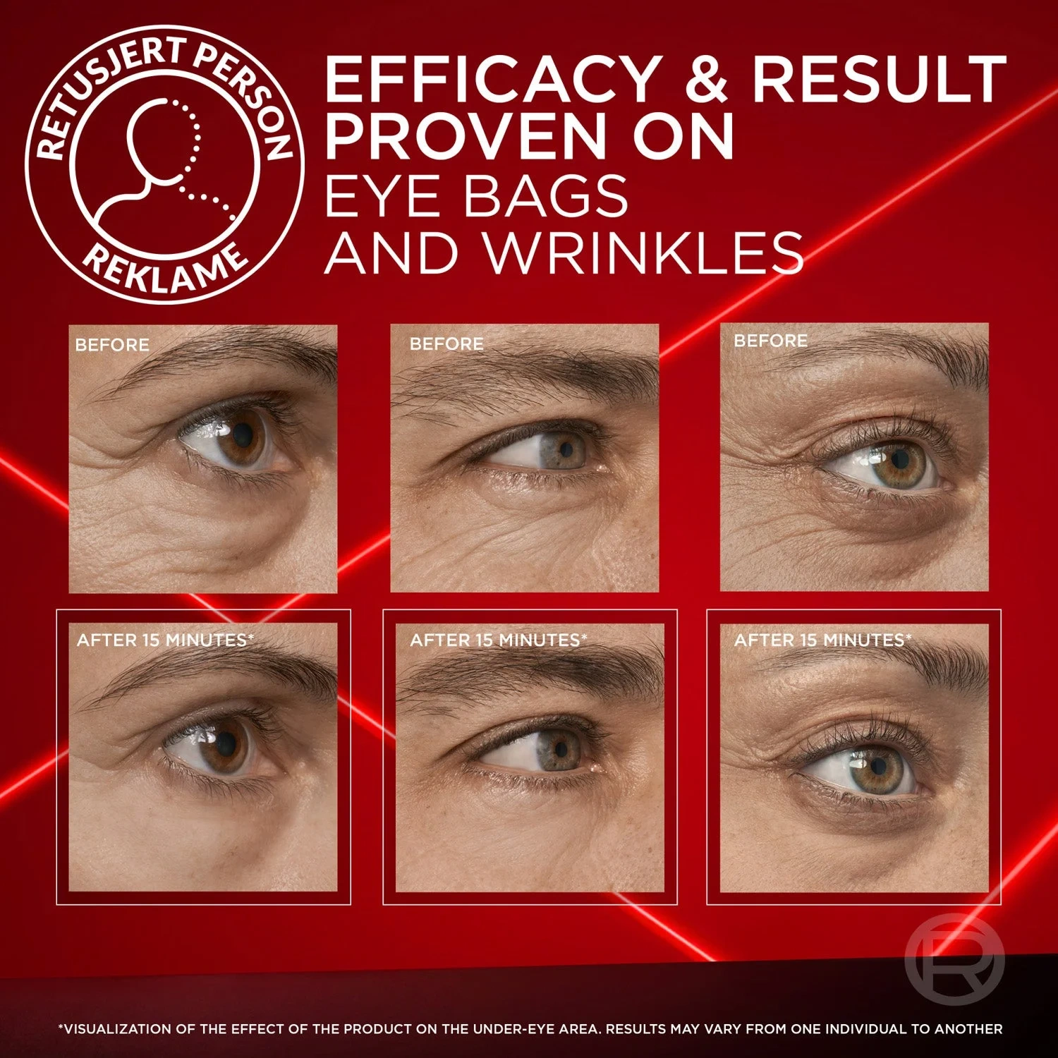 Revitalift Laser Eye Bag Instant Eraser