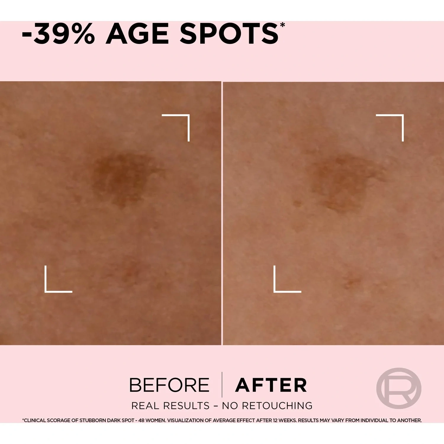 L'Oréal Paris Age Perfect Golden Age Spot Corrector 30 ml