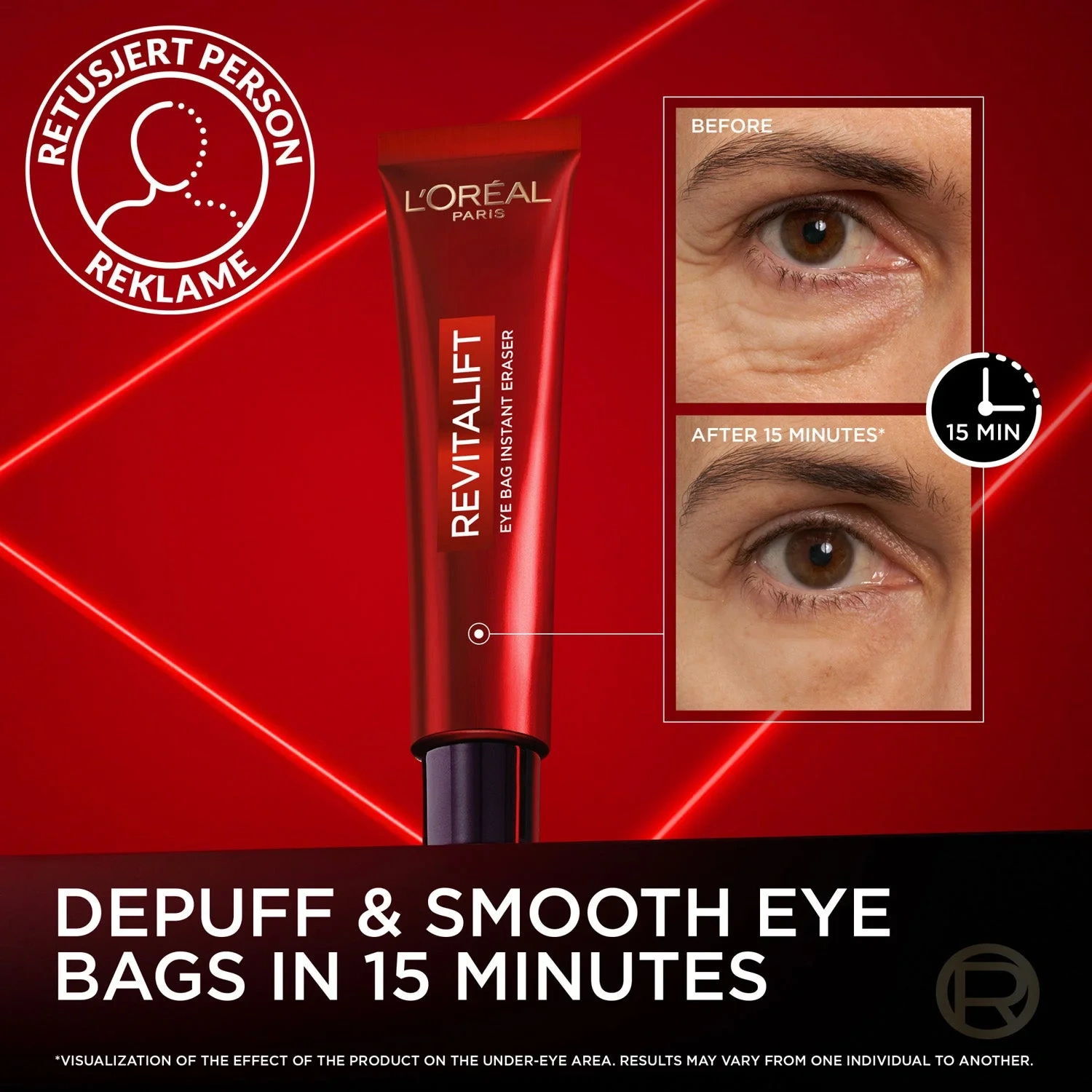 Revitalift Laser Eye Bag Instant Eraser