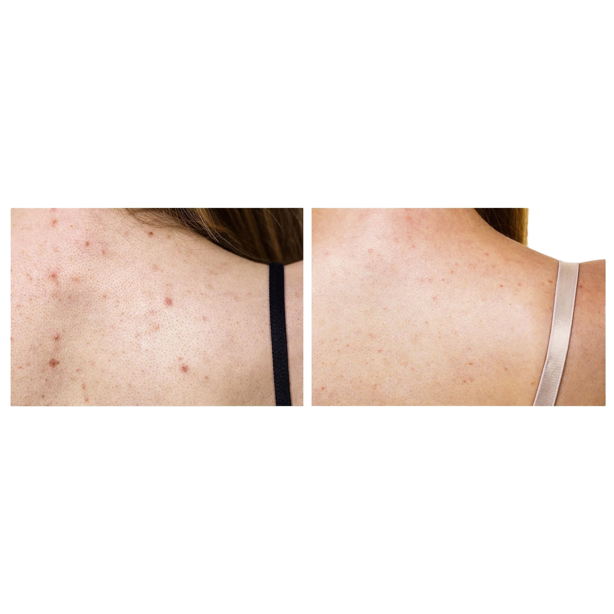 FAQ Swiss FAQ™ 211 LED Neck & Décolleté Mask