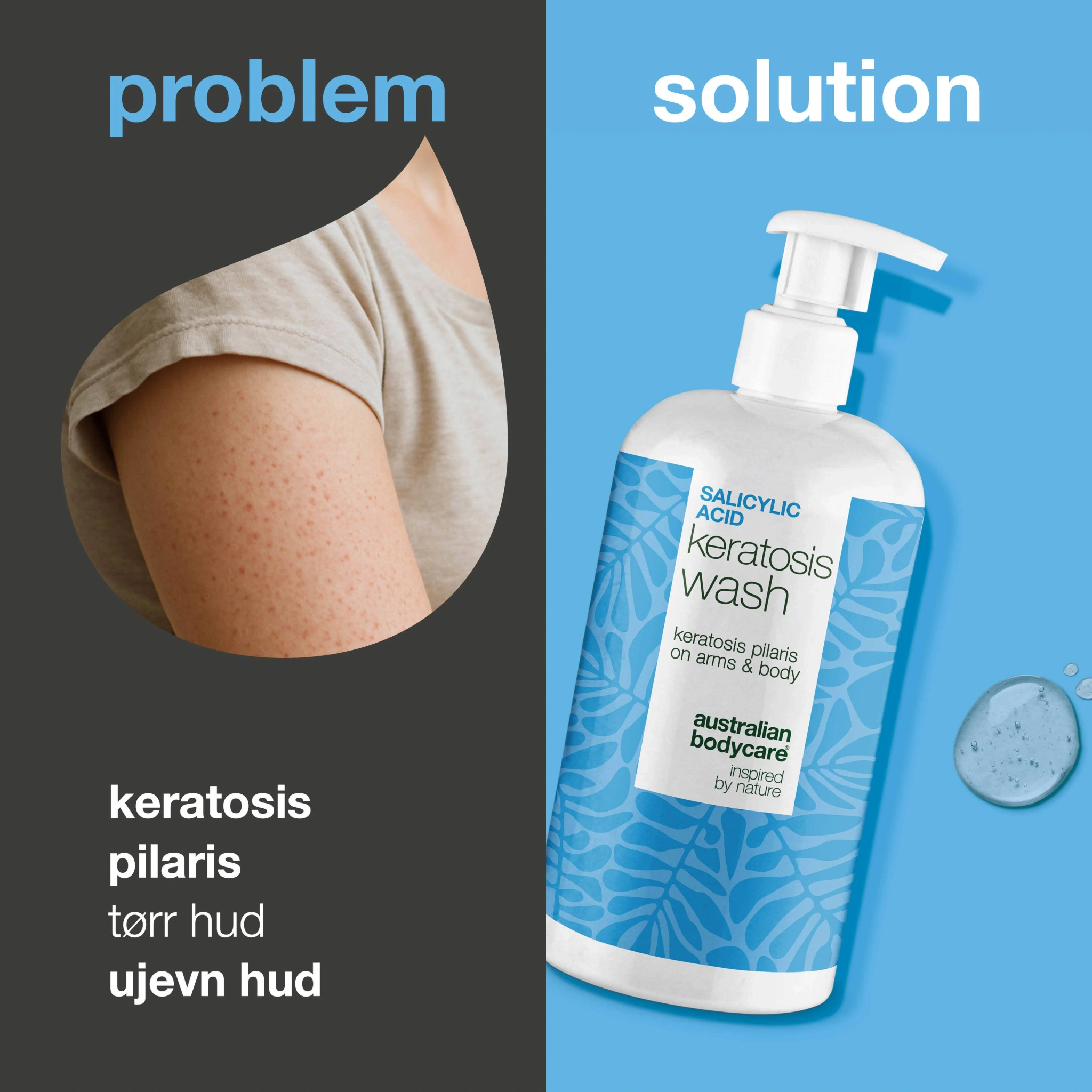 Keratosis Pilaris duschtvål