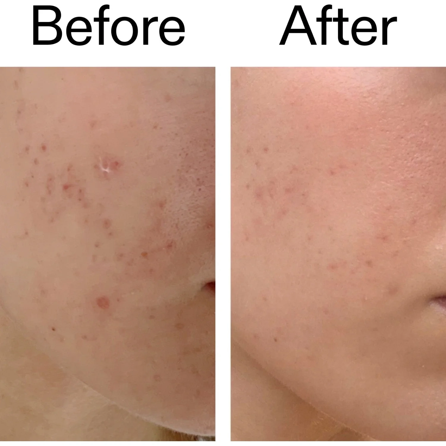 The Inkey List Mandelic Acid Treatment 15 ml