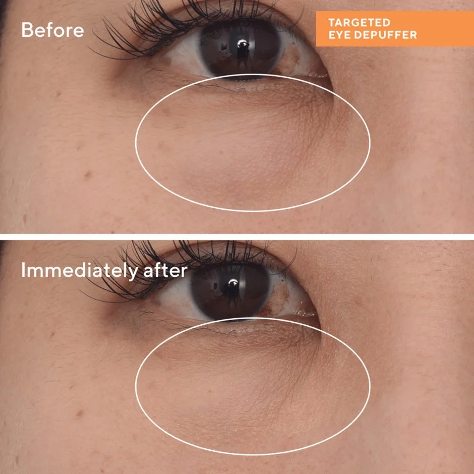 Murad Targeted Eye Depuffer