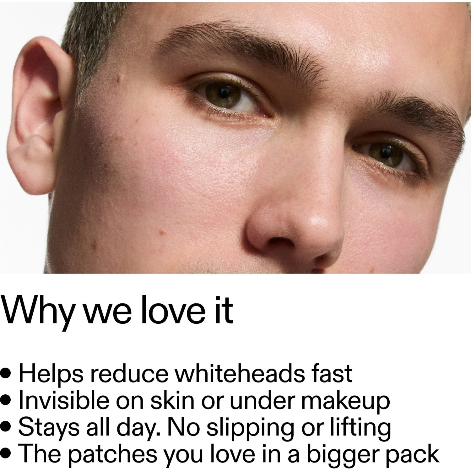 The INKEY List Hydrocolloid Pimple Patches