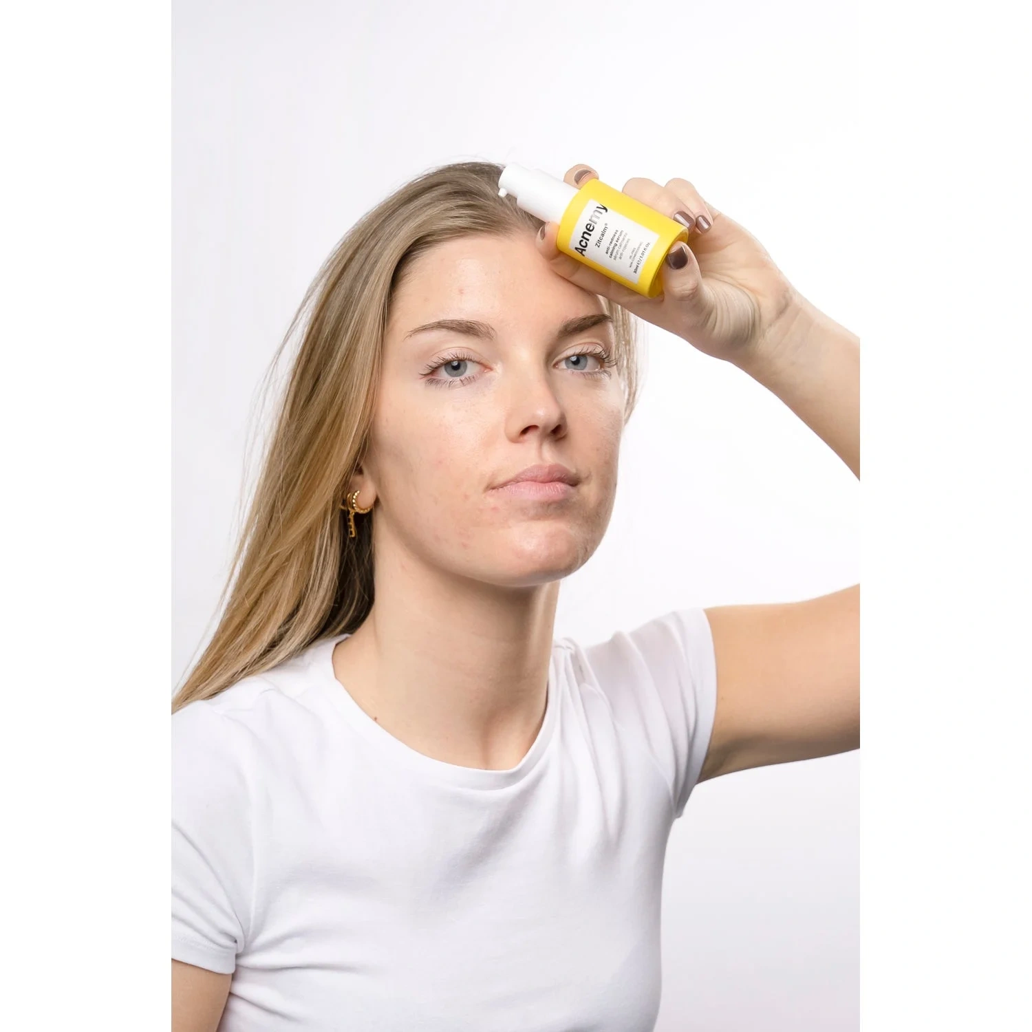 Niche Beauty Lab Acnemy
