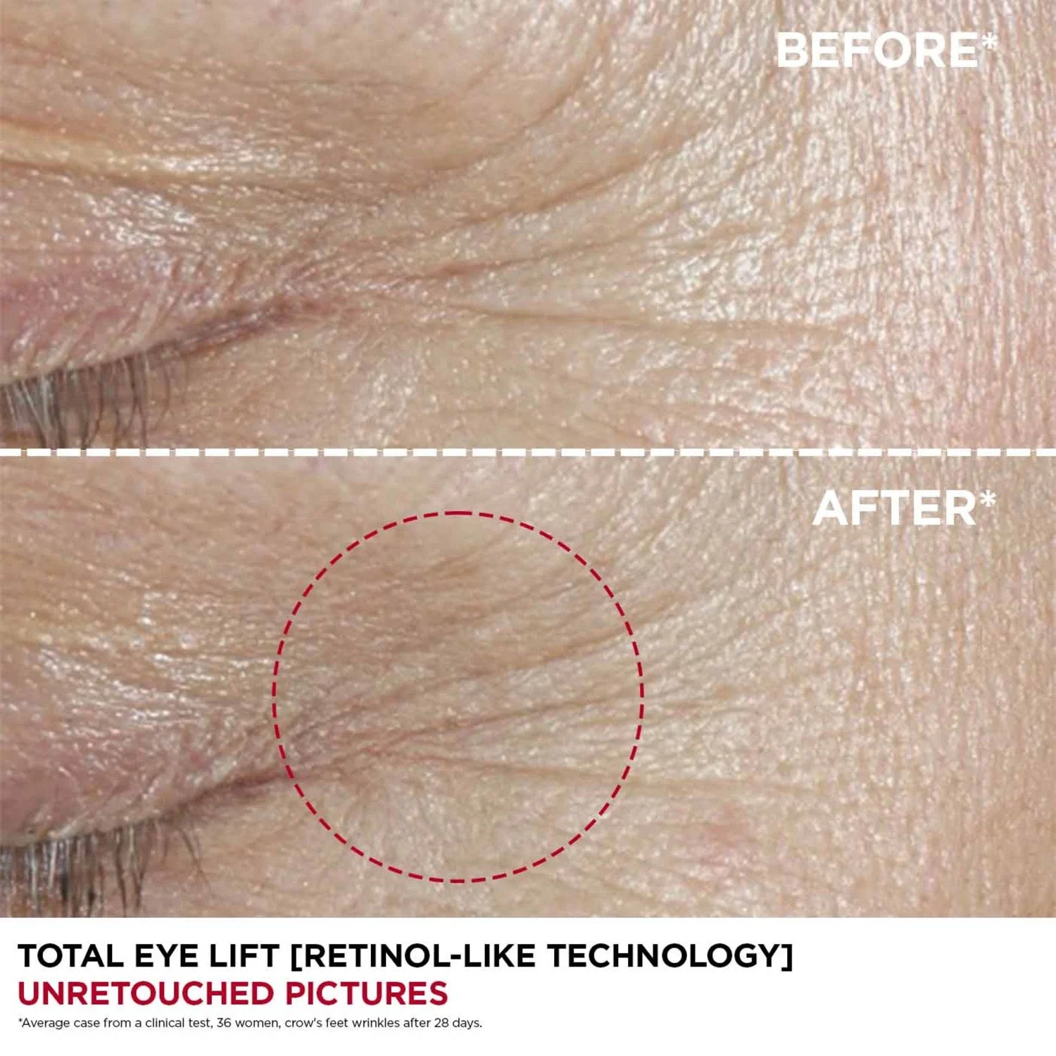 Clarins Total Eye Lift - Lift-Replenishing Eye Concentrate 15 ml