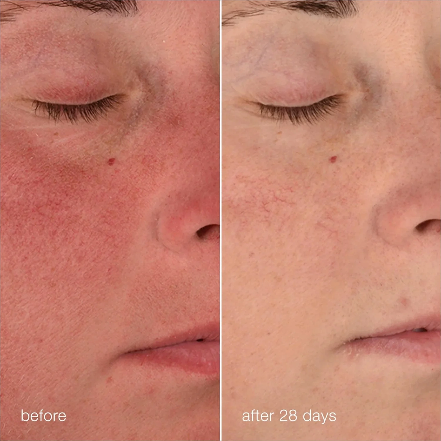 Dermalogica Stabilizing Repair Cream