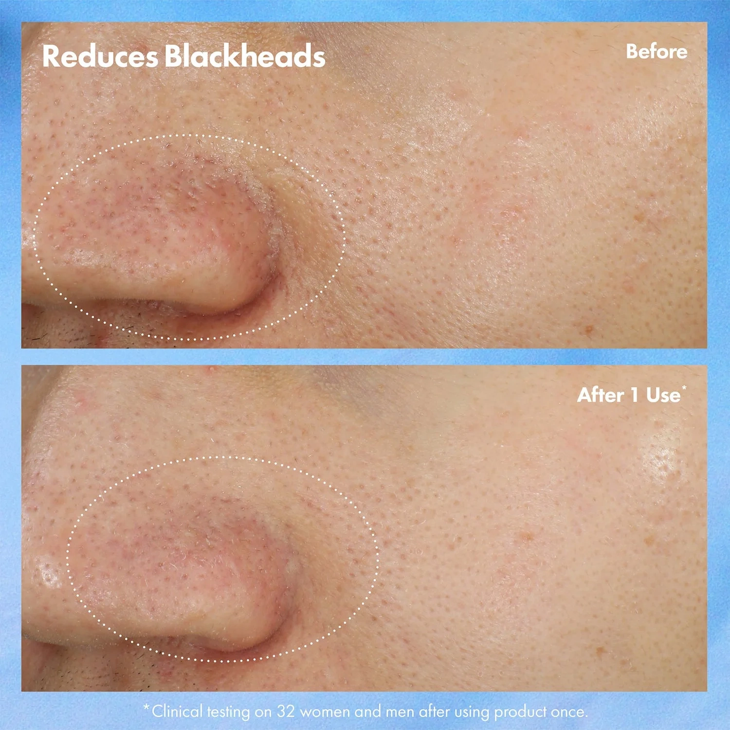 Origins Clear Improvement Blackhead Clearing Mask-To-Scrub