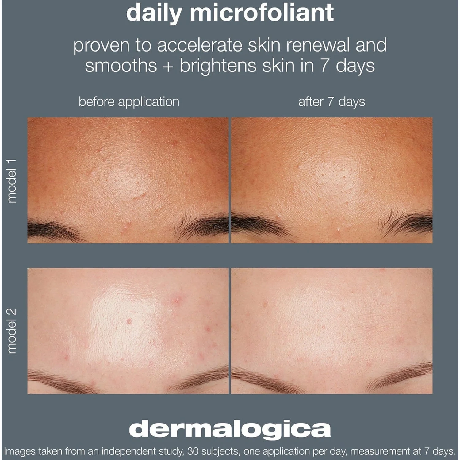 Dermalogica Daily Microfoliant - Peeling