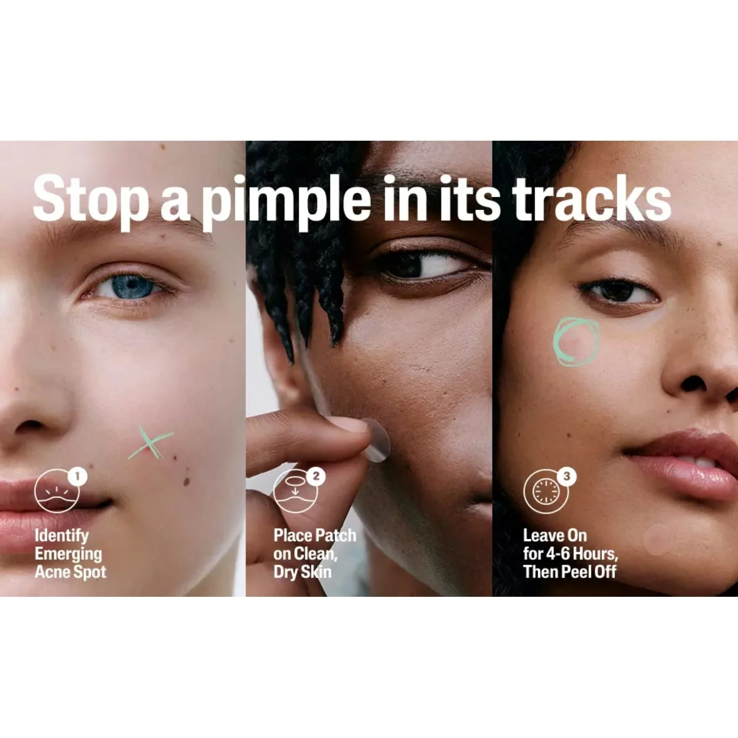 Cetaphil 6h Fast Clear Pimple Patch