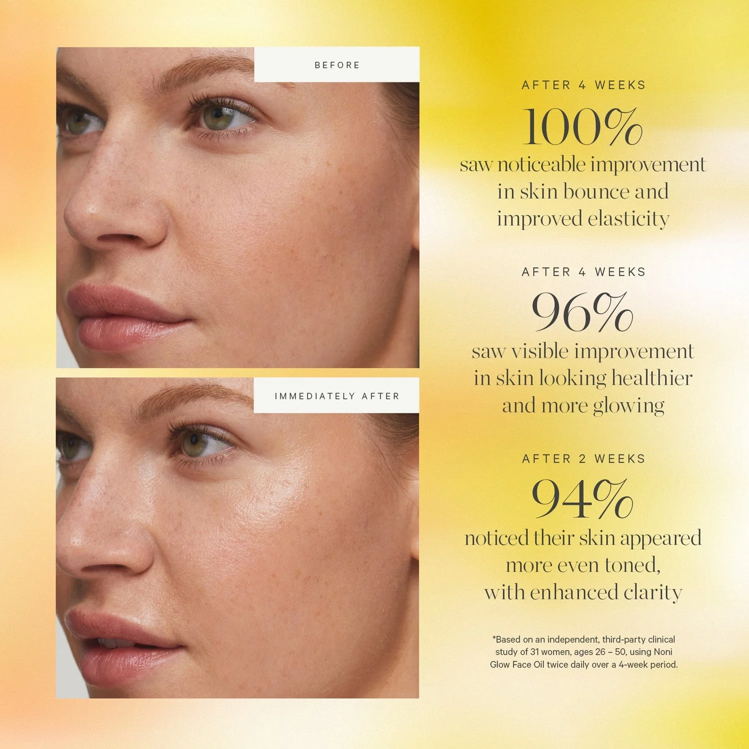 KORA Organics Noni Glow Face Oil