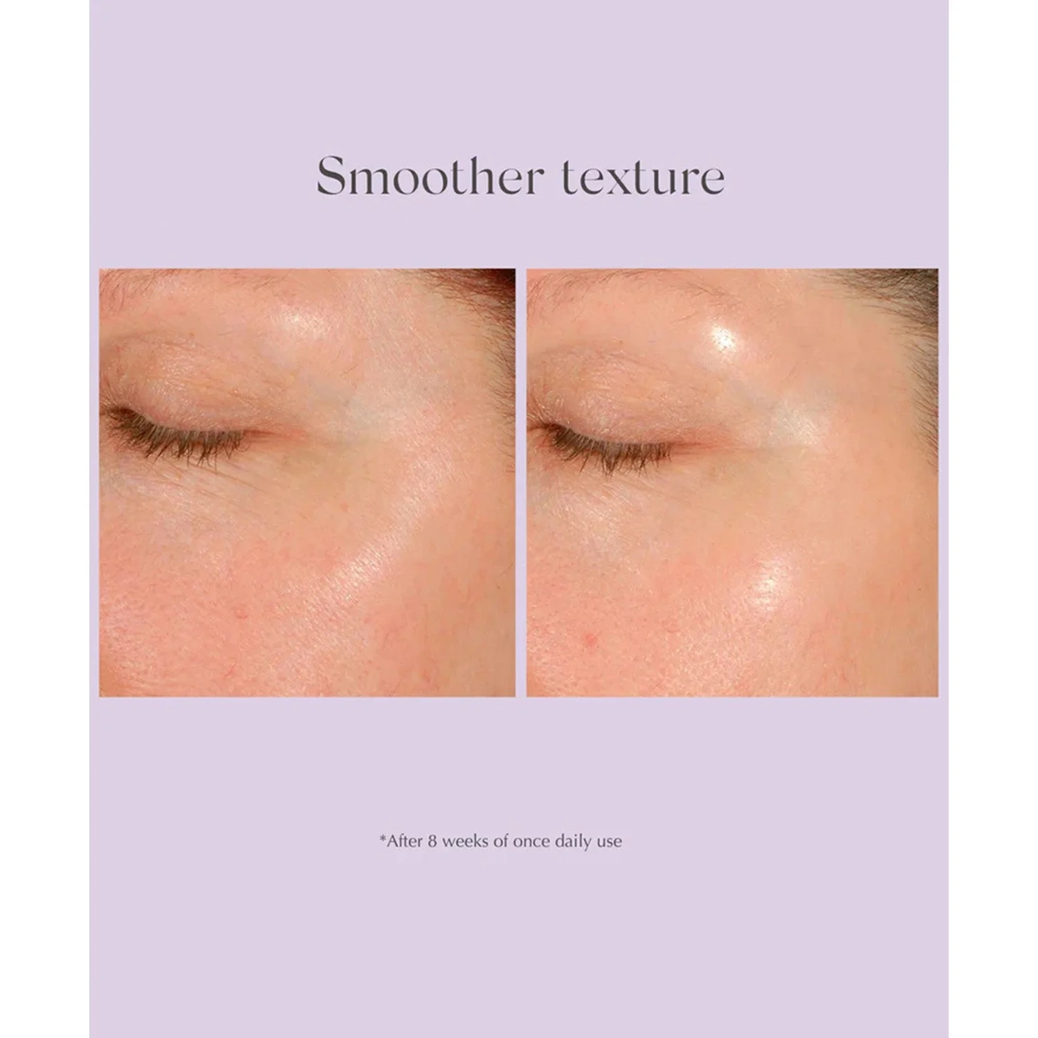 Exuviance Daily Resurfacing Peel