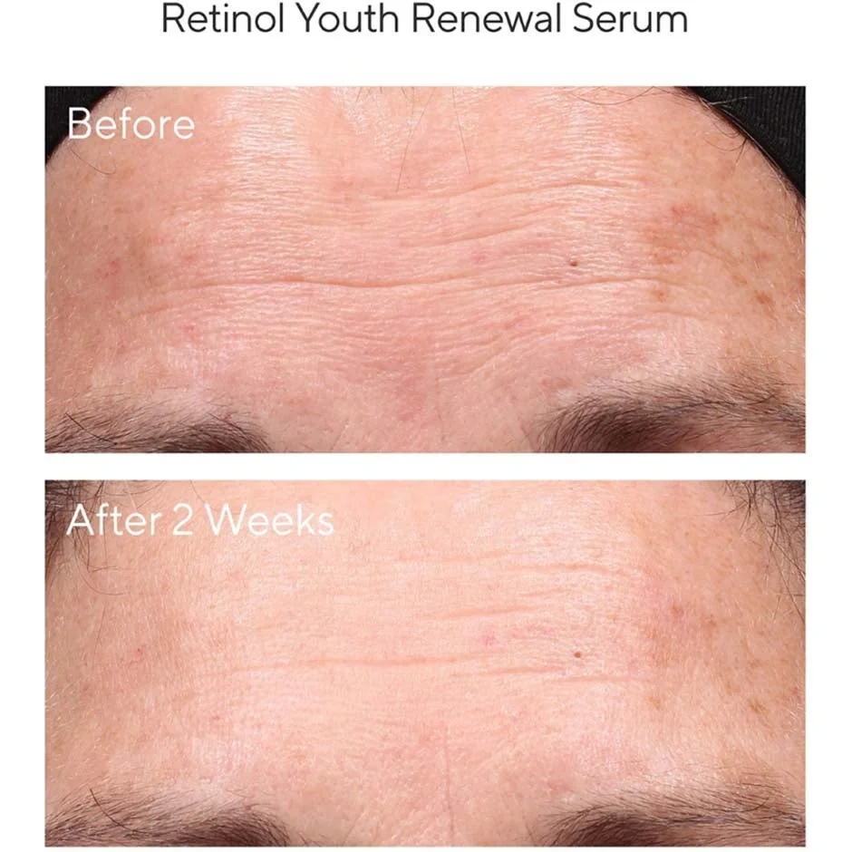 Murad Resurgence Retinol Youth Renewal serum 30 ml