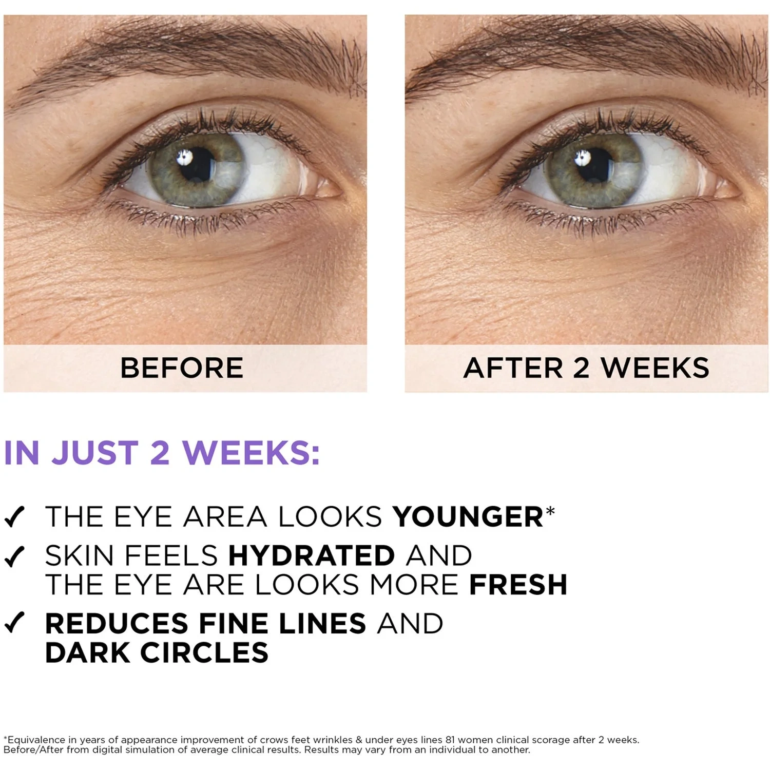 L'oreal Revitalift Filler Eye Serum 20ml