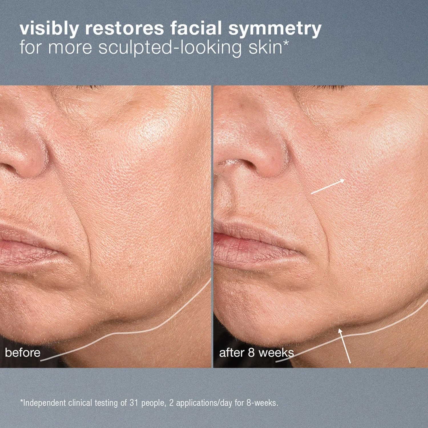 Dermalogica Neurotouch Symmetry Serum