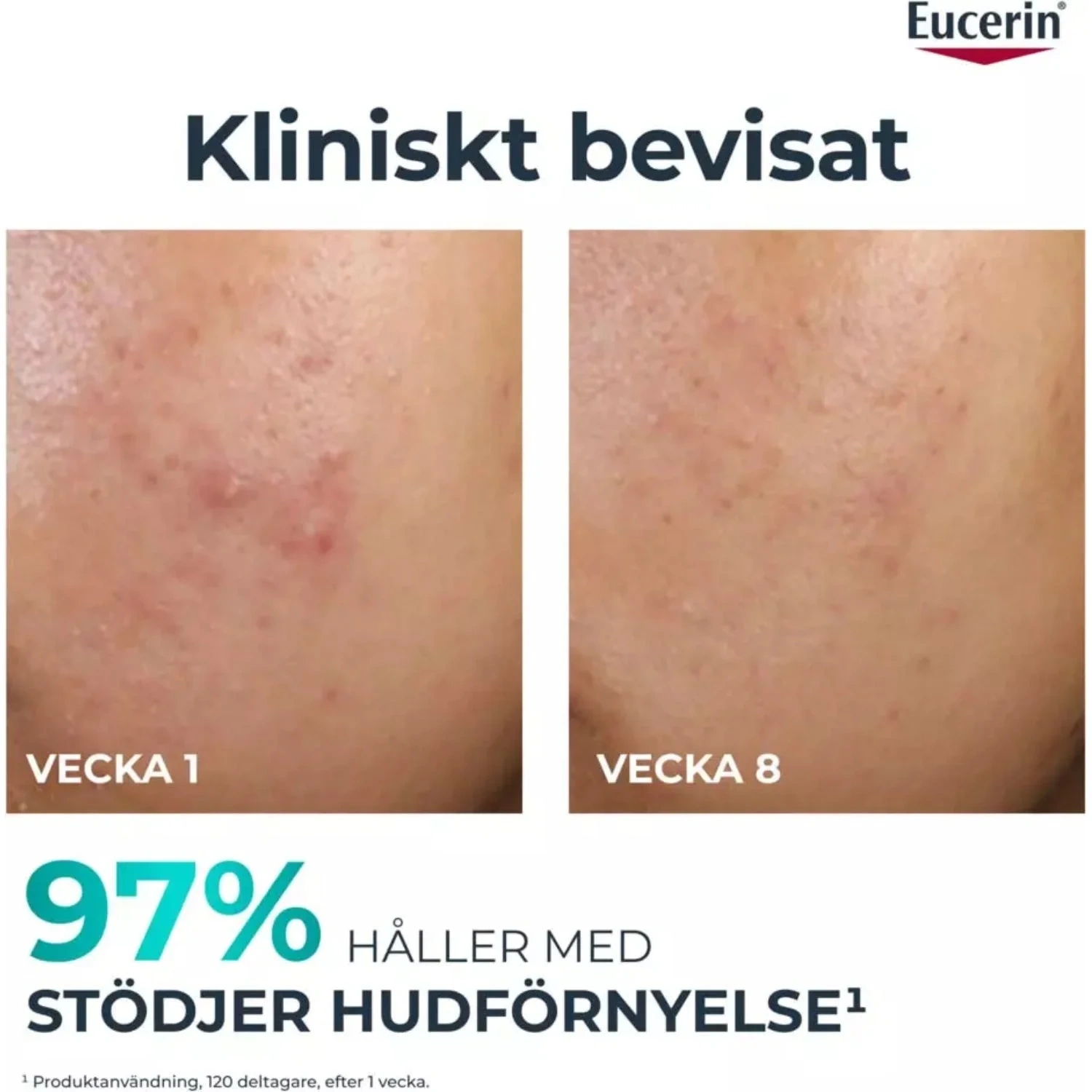 Eucerin Nattpeeling DermoPure Peeling 10