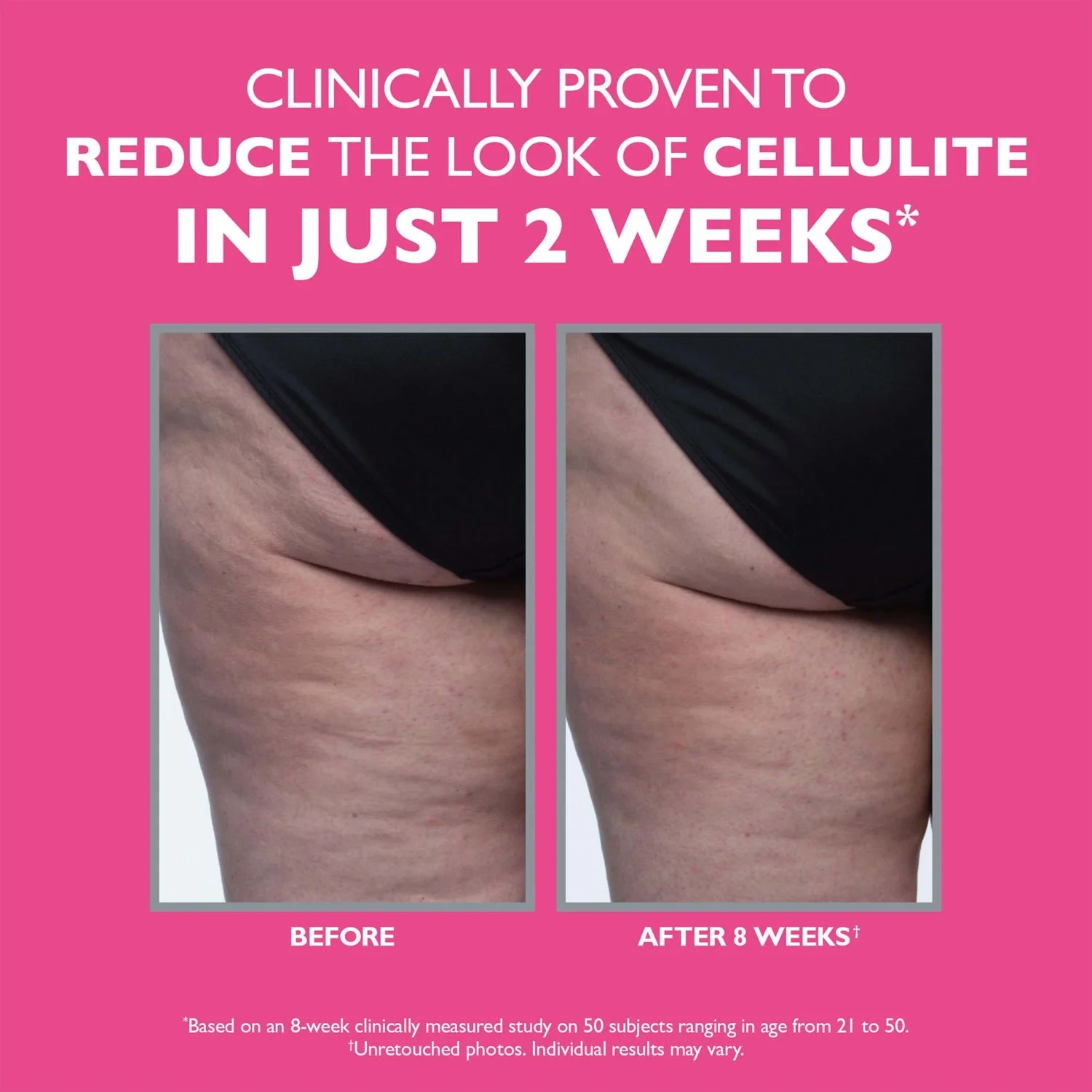Peter Thomas Roth Firmx® Tight & Toned Cellulite Treatment