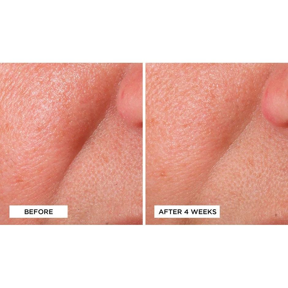 Perricone MD Cold Plasma + Face