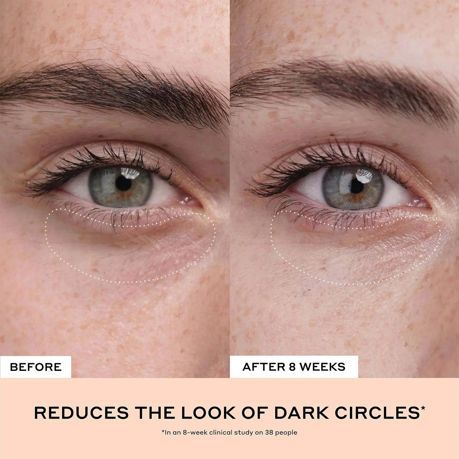 Ole Henriksen Clinical Quick Fix Mini Set