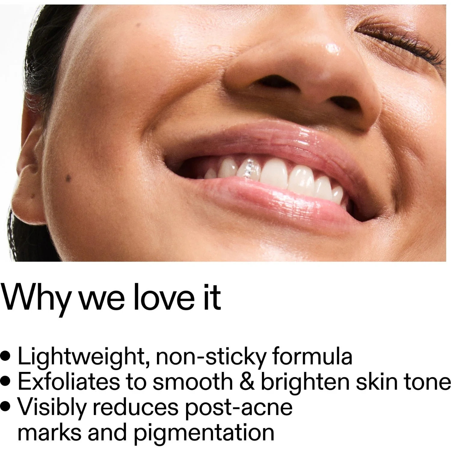 The Inkey List Mandelic Acid Treatment 15 ml