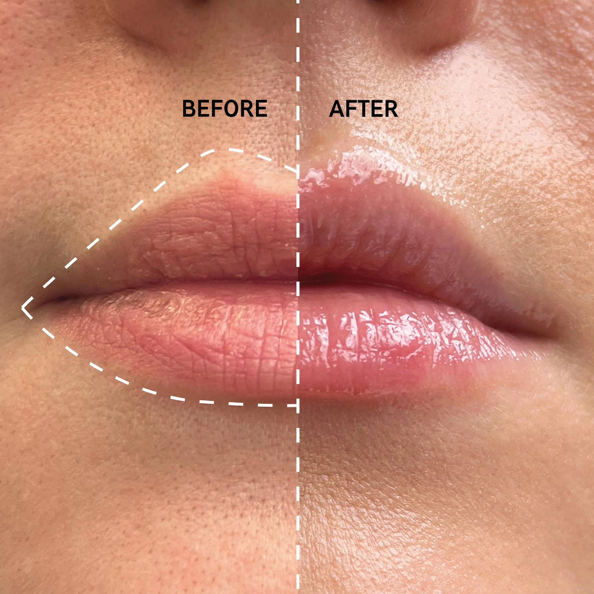 The Inkey List Tripeptide Plumping Lip Balm, 10 ml
