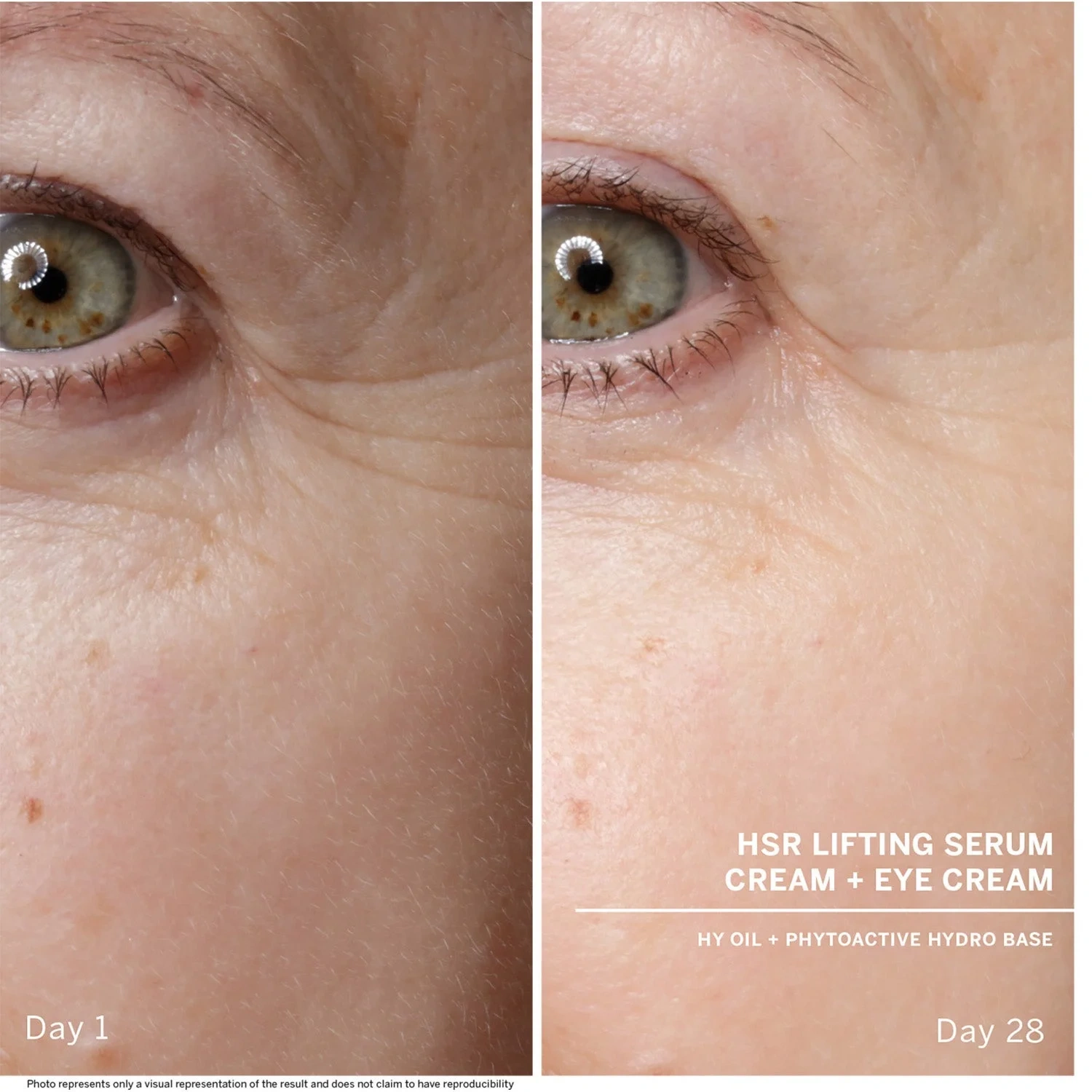 BABOR HSR Lifting Anti-Wrinkle Serum, 30 ml