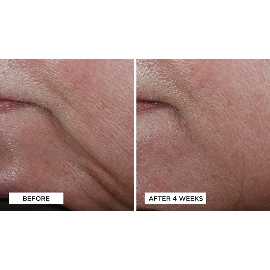 Perricone MD High Potency Classics