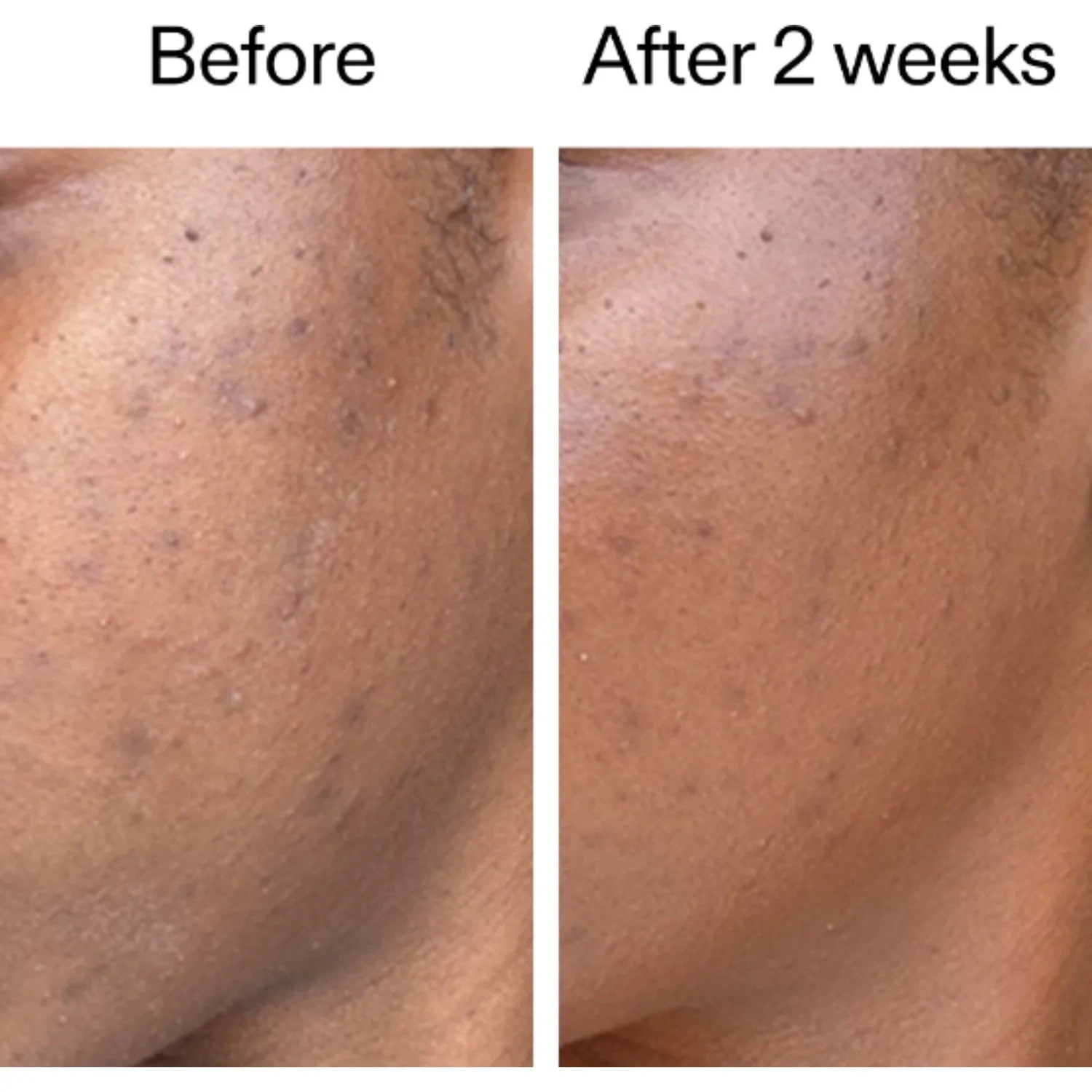 The INKEY List 360° Skin Clearing Serum 30 ml