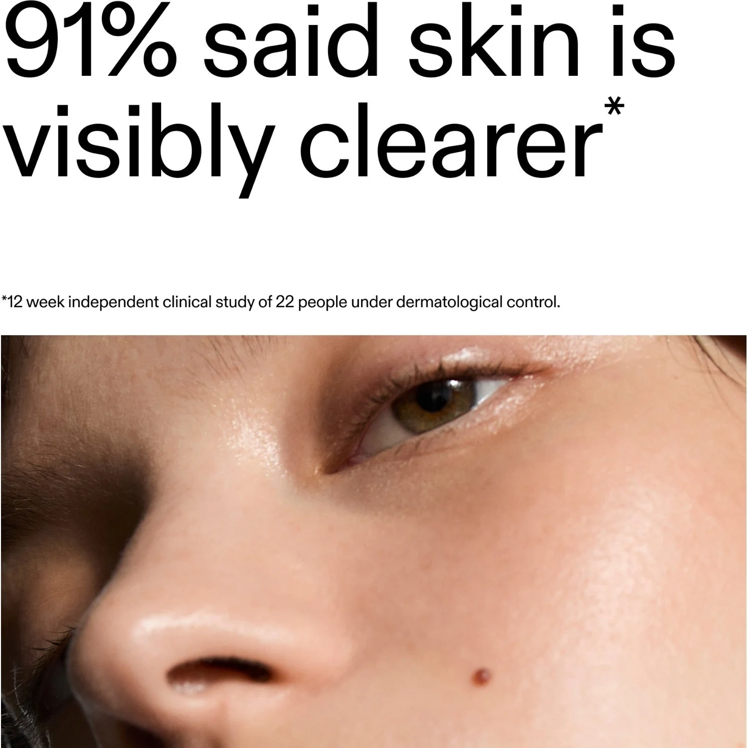 The Inkey List Blemish Moisturizer 50 ml