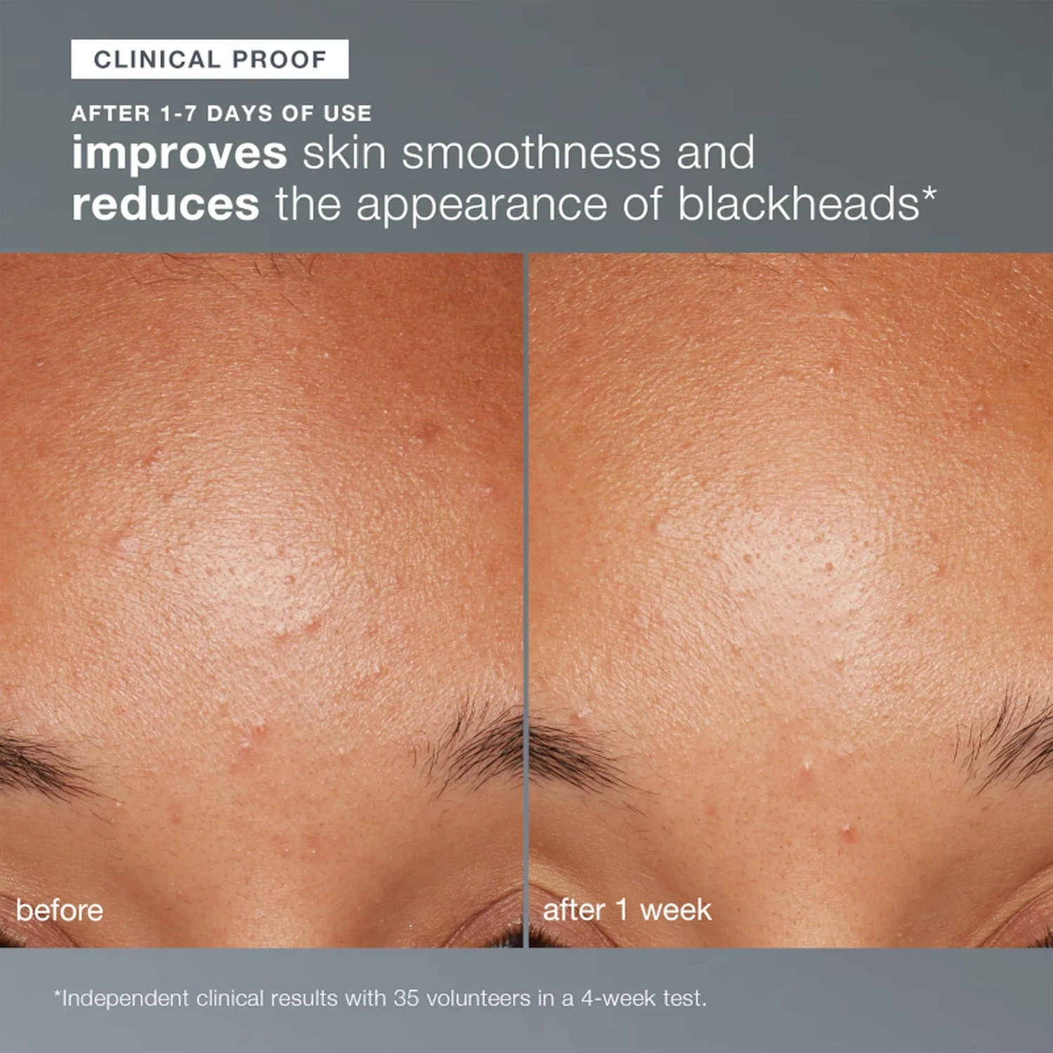 Dermalogica Daily Milkfoliant