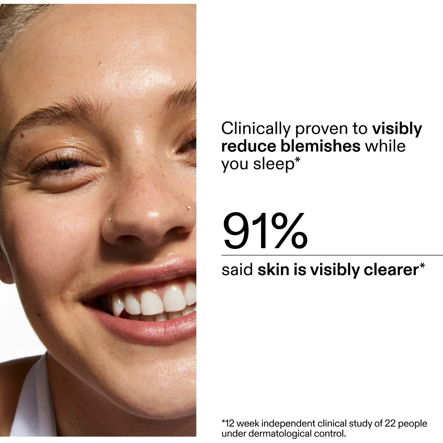The Inkey List Blemish Moisturizer 50 ml