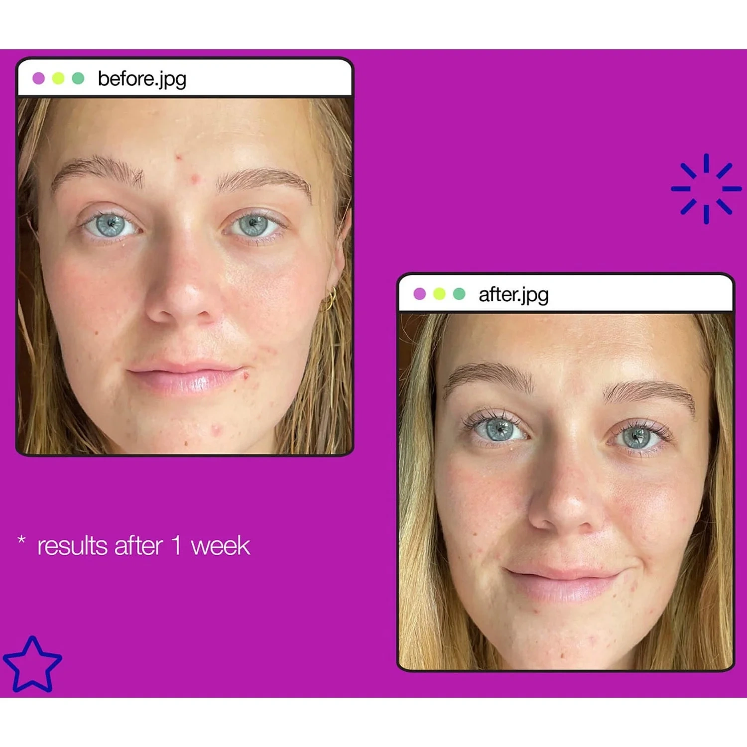 Dermalogica Post-Breakout Fix