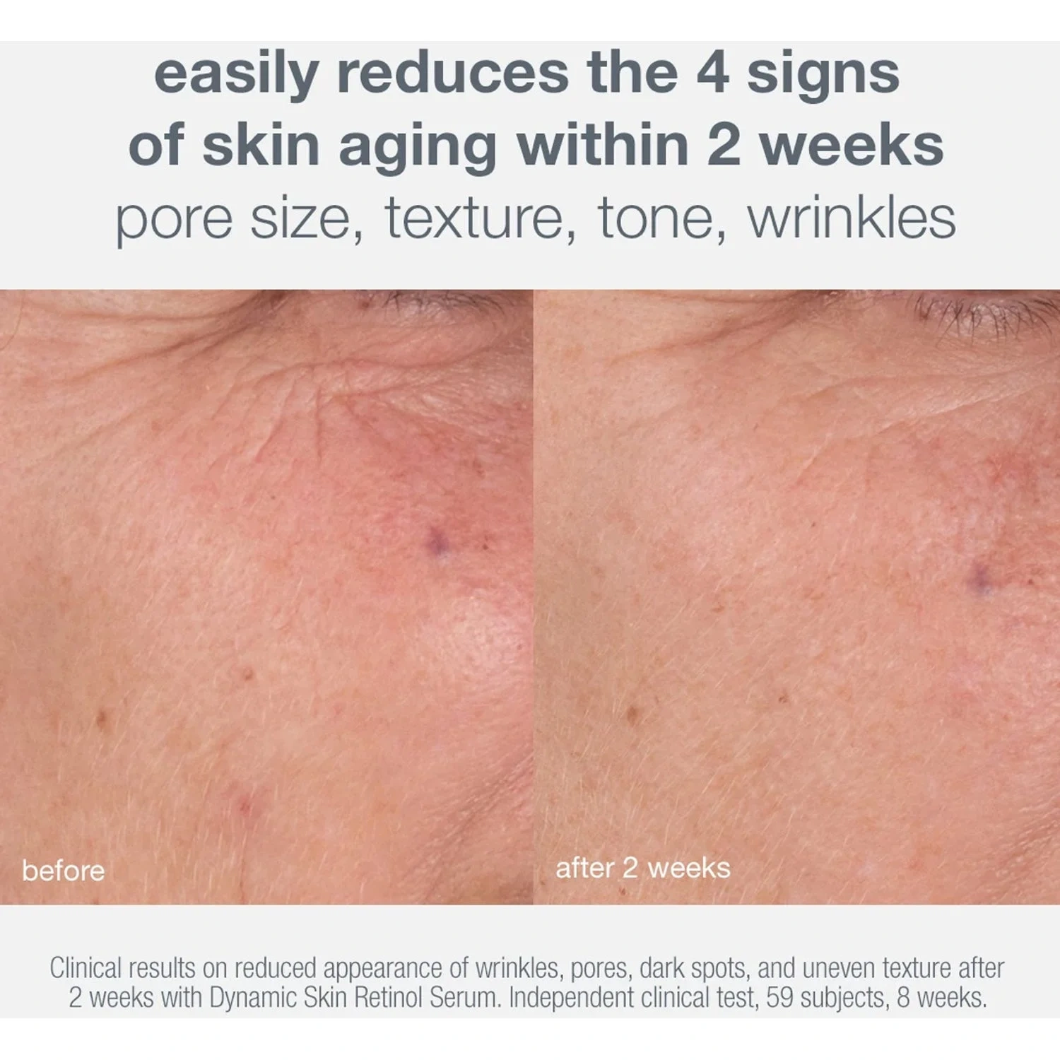 Dermalogica Skin Aging Solutions