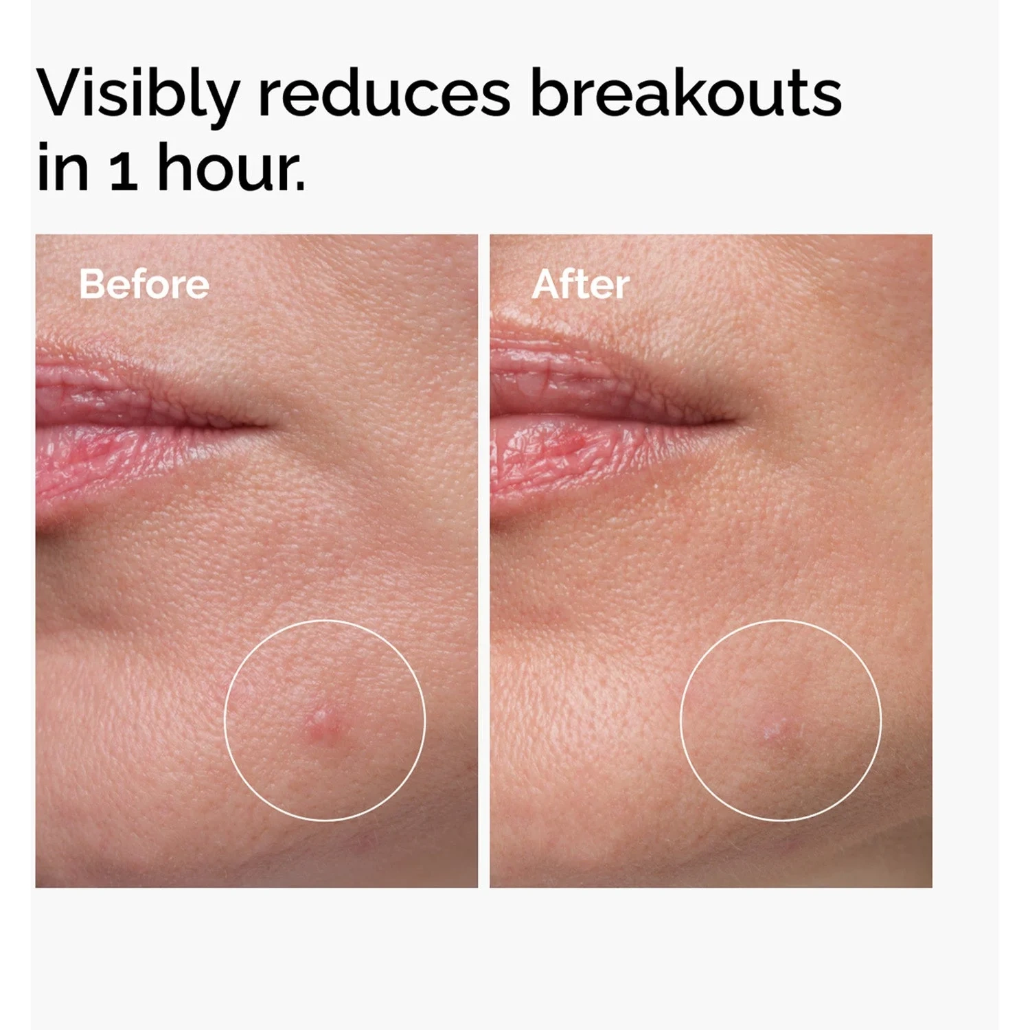 The Ordinary Sulfur 10% Powder-To-Cream Concentrate