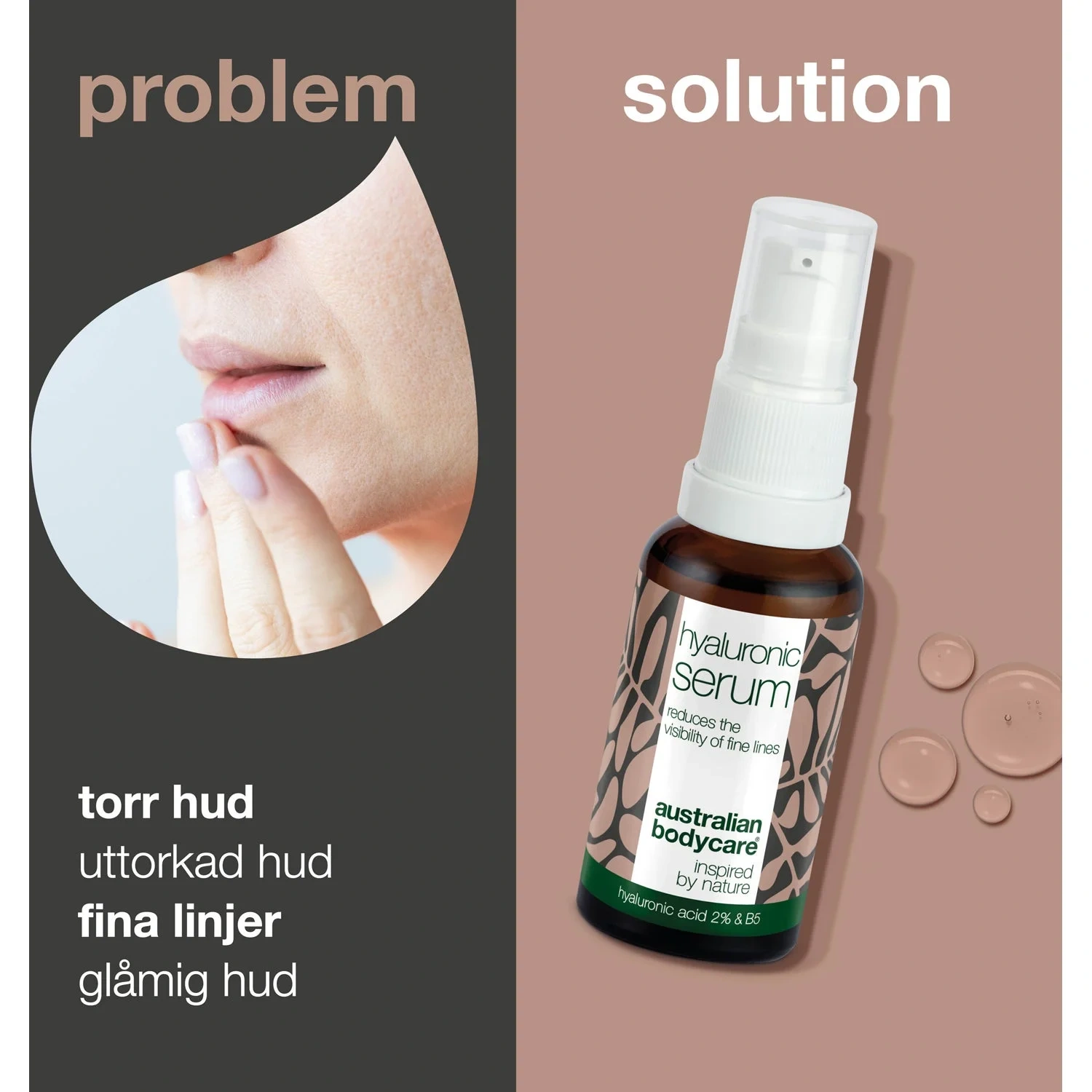 Australian Bodycare 2% Hyaluronic Acid Serum – Hydrates, Soothes And Softens Sensitive Skin 30 ml