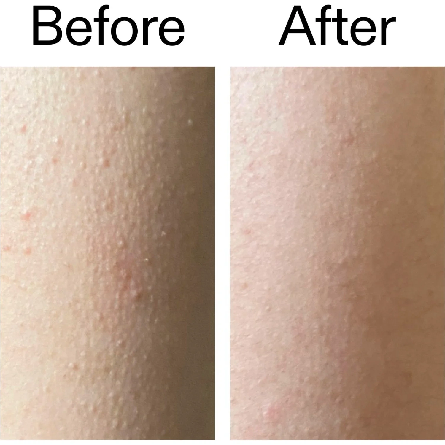 The Inkey List Glycolic Body Stick 45 g