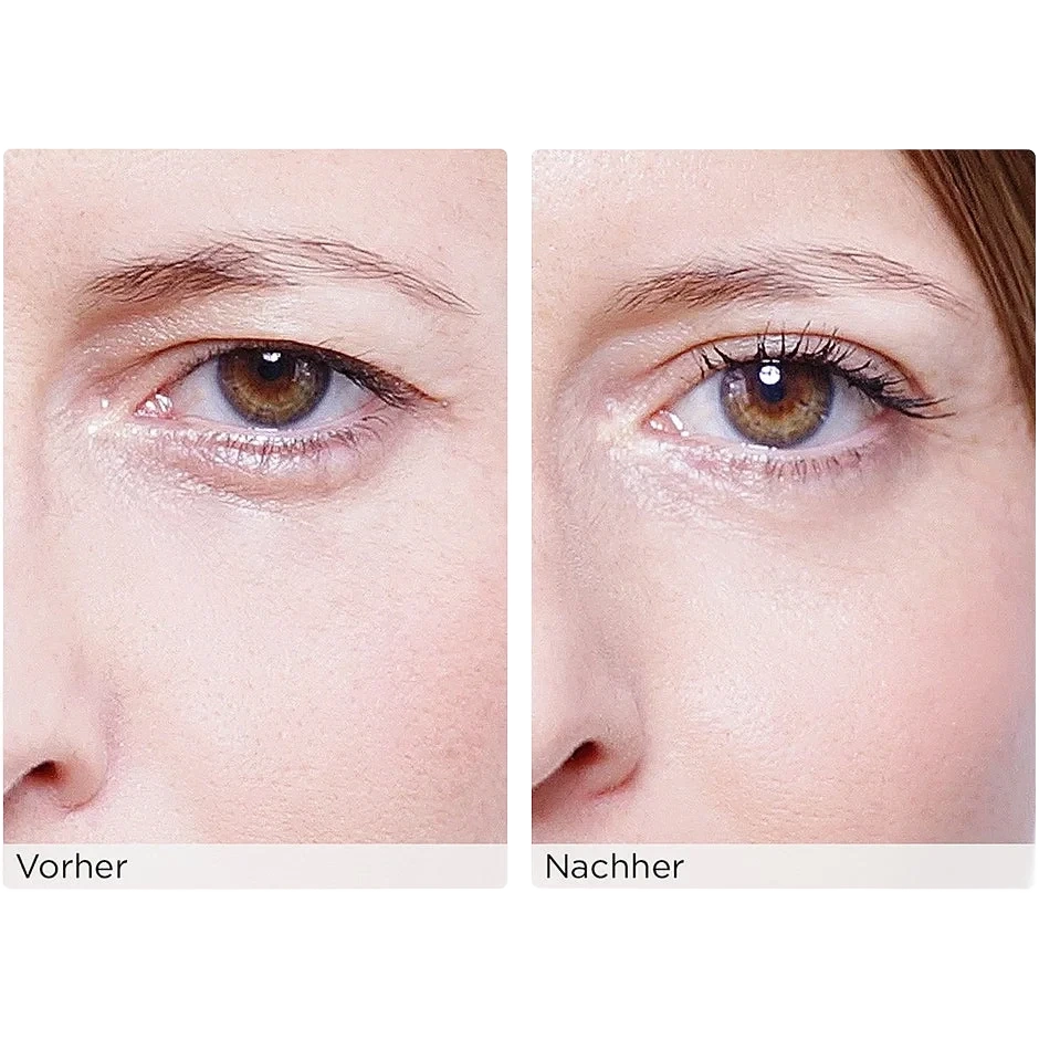 Wonderstripes The Instant Eye Lift Without Surgery