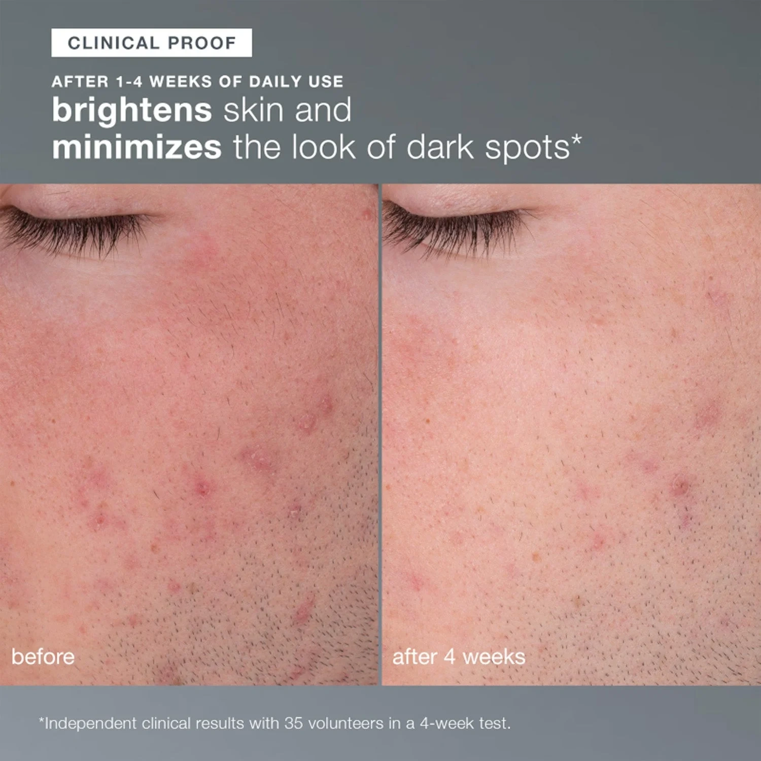 Dermalogica Daily Milkfoliant