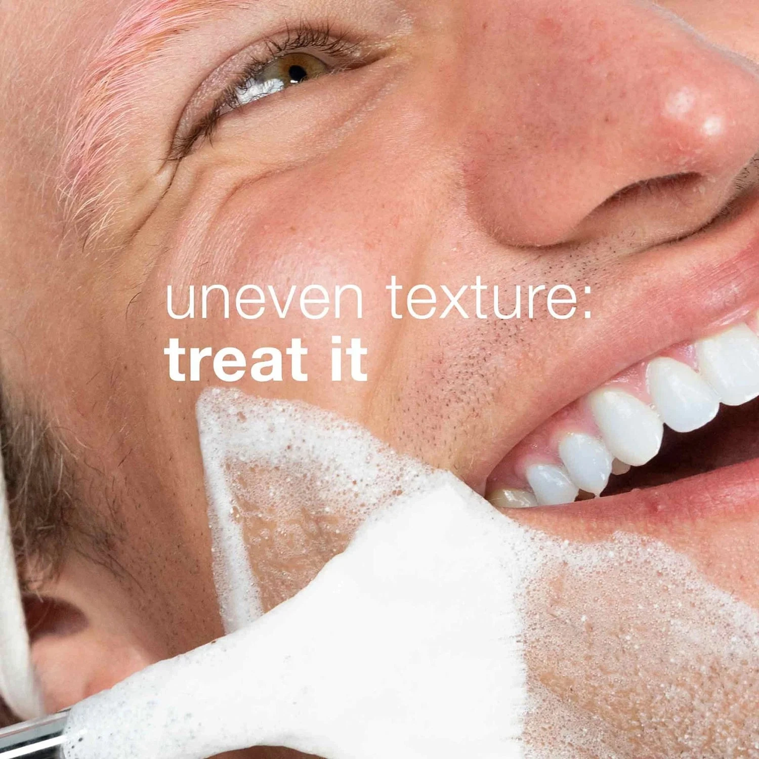 Dermalogica Daily Microfoliant - Peeling
