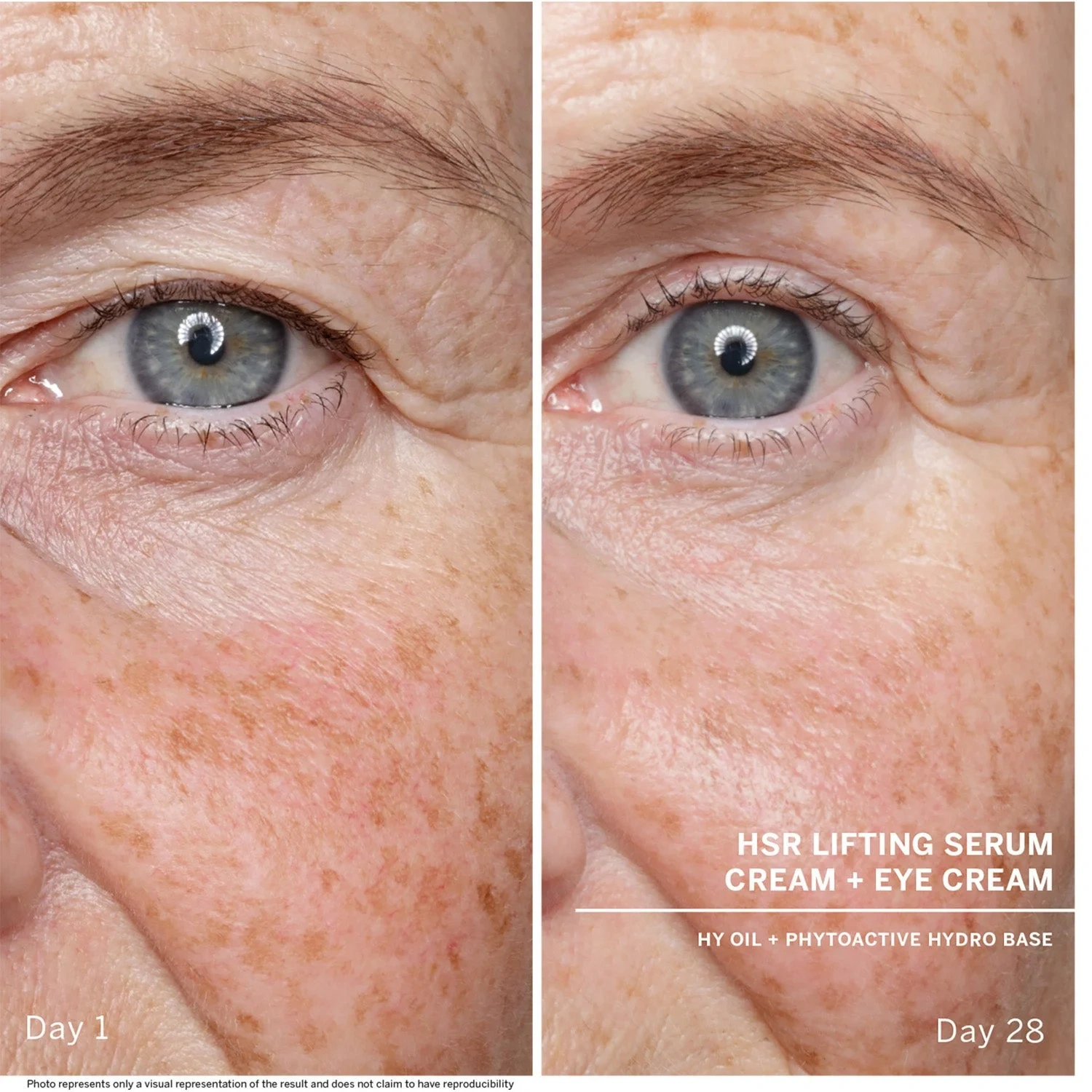 BABOR HSR Lifting Anti-Wrinkle Serum, 30 ml