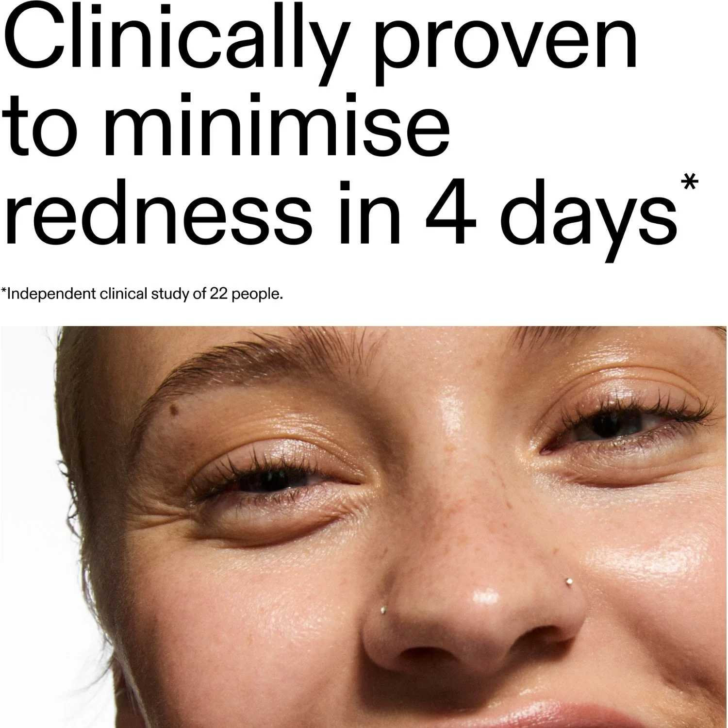 The INKEY List Azelaic Acid 10% Serum