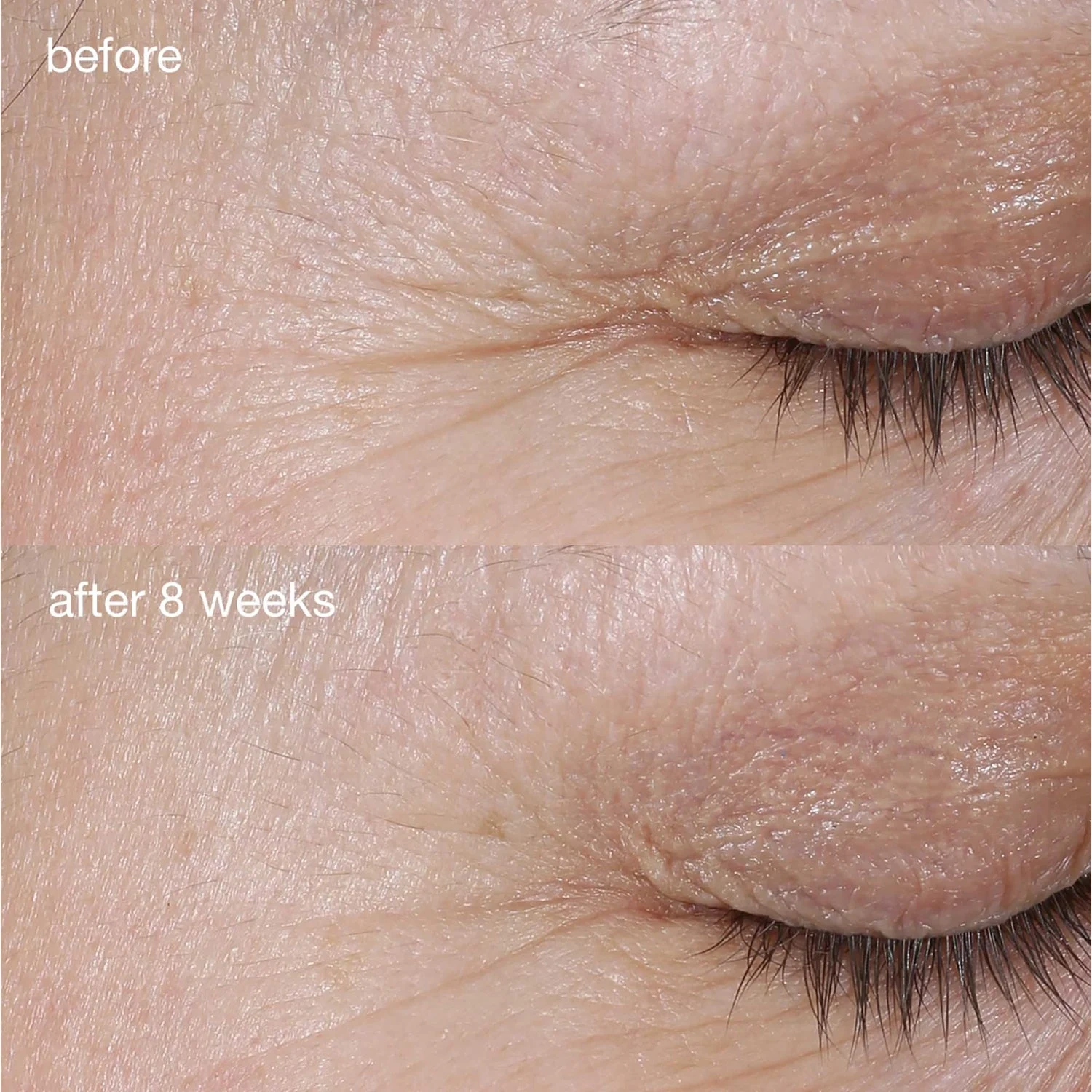Dermalogica AGE smart