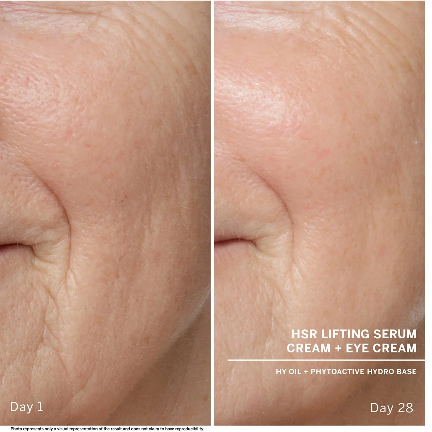 BABOR HSR Lifting Anti-Wrinkle Serum, 30 ml