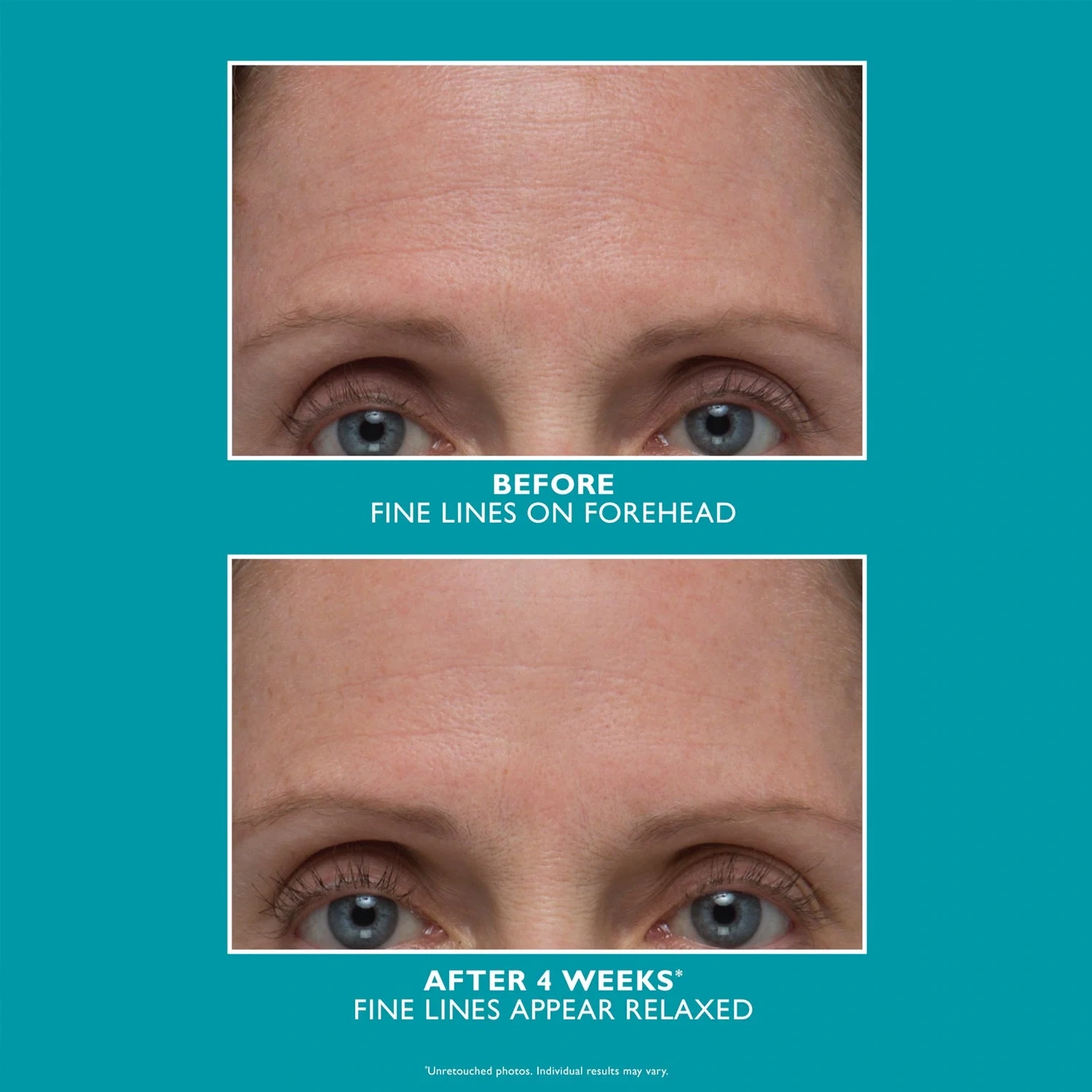 Peter Thomas Roth Peptide Skinjection™ Amplified Wrinkle-Fix Serum