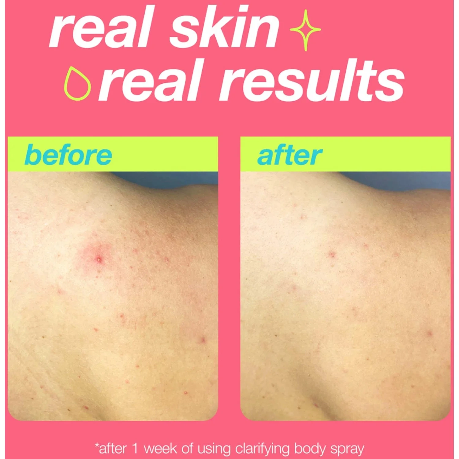 Dermalogica Clarifying Body Spray